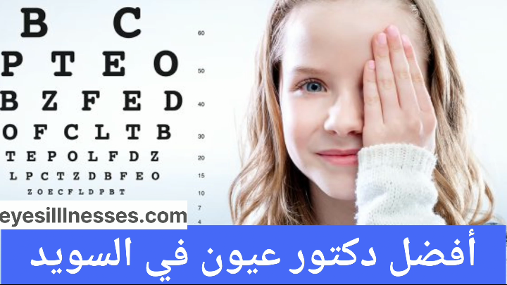 أفضل دكتور عيون في السويد
